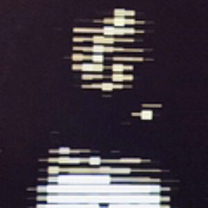 Profile photo of Bradismus